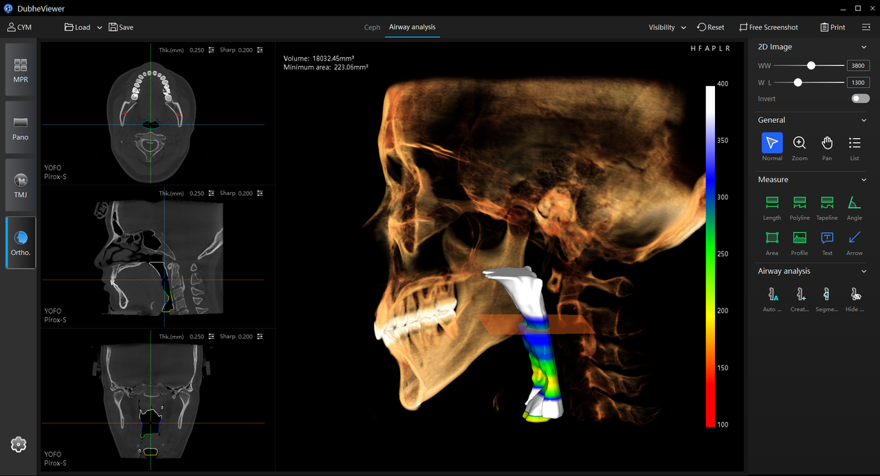 Cross-sectional airway area measurement