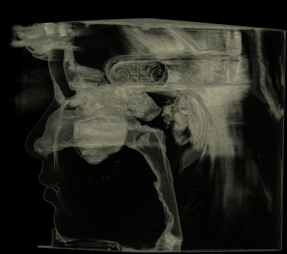 Soft tissue rendering mode one