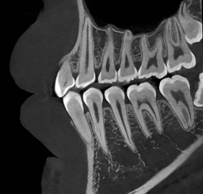 High-resolution sagittal dental CT image