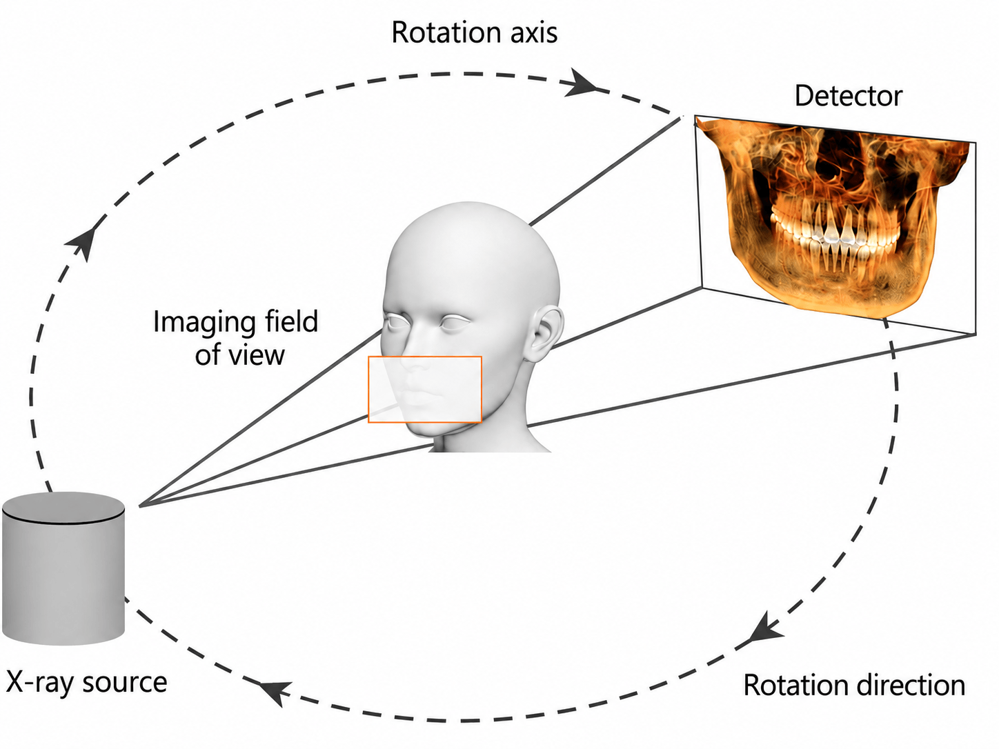 Principle of cone beam computed tomography imaging