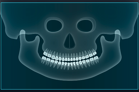 FOV 20 x 18 image 3