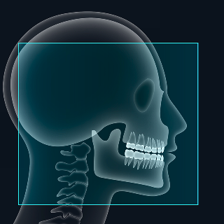 FOV 20 x 18 image 2