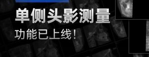 有方口腔CT单侧头影测量功能已上线！