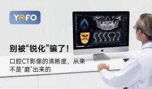 别被“锐化”骗了！口腔CT影像的清晰度，从来不是“磨”出来的